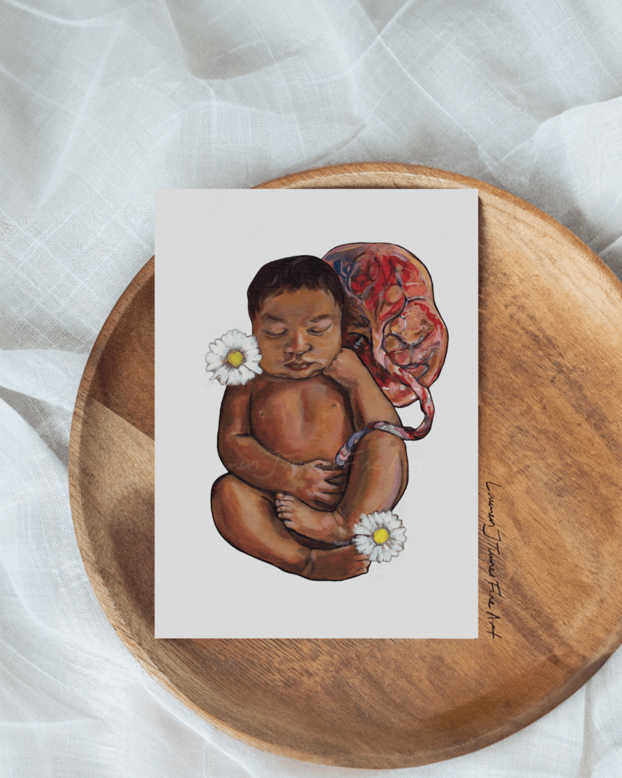 Daisy Baby with Placenta - Image 4